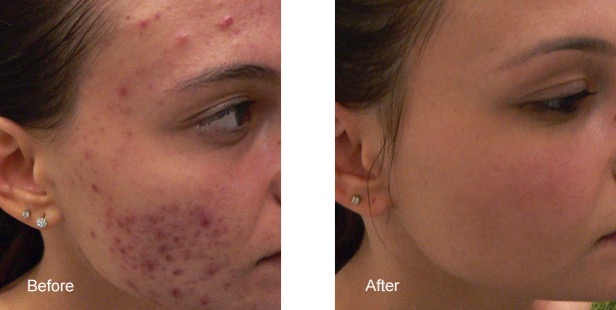 Red Light Therapy Anti Aging Secret Weapon Dermstore Blog
